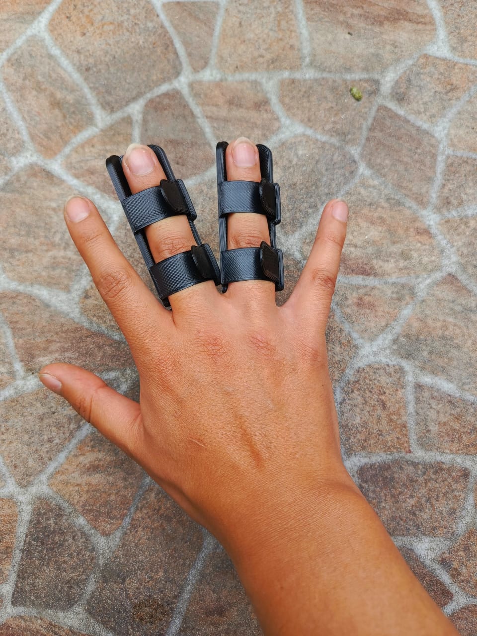 Inmovilización postoperatoria de dedos